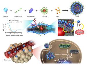 Liposomes embedded with PEGylated ultrasmall iron oxide nanoparticles integrate ferroptosis activation, MRI tracing, and pH/ROS-sensitive drug delivery for combination cancer therapies.