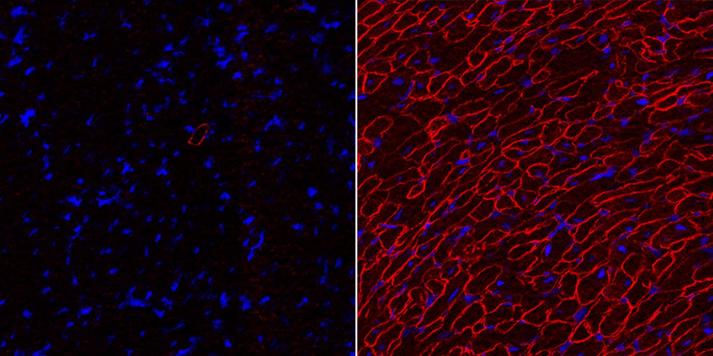 An Efficient Strategy to Edit Common Mutation that Causes Duchenne Muscular Dystrophy (4 of 5)