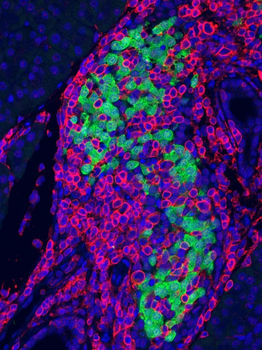 Disrupted RNA Editing in Beta Cells: Pancreatic Inflammation Unveiled