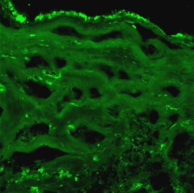 Factors Increase Blood Supply