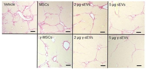 The therapeutic effects of AD-MSC-γ-sEVs were superior to those of AD-MSC-sEVs in mice
