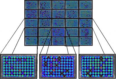Imaging Technology Aids in Cancer Treatment
