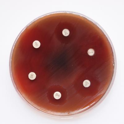 Zone of Inhibition Test