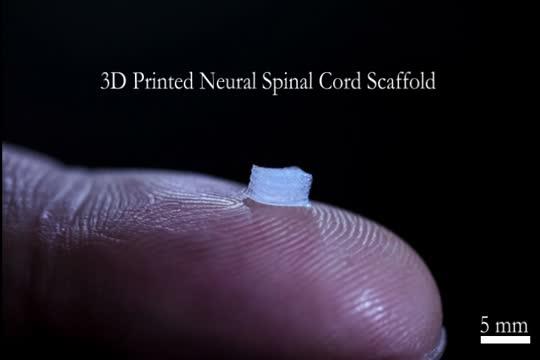 3D-Printed Guide Could Help People with Spinal Cord Injuries