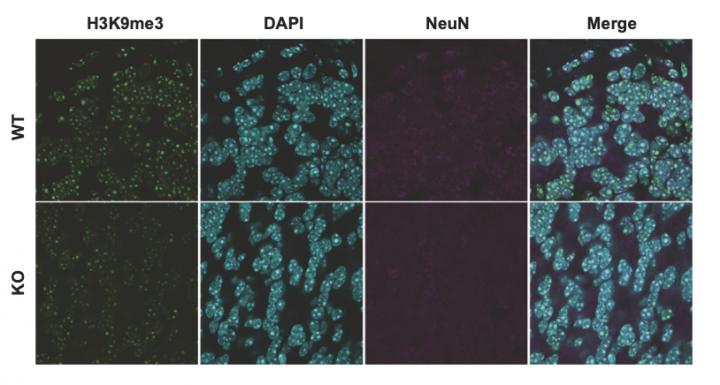 Suv39h2 deficiency in the mouse brain