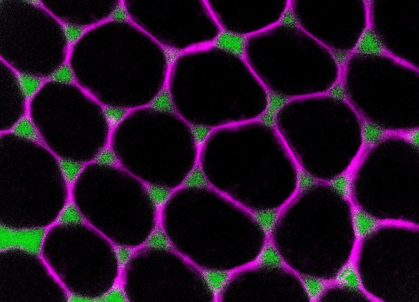 Epithelial Cells Enclosing a Developing Egg Cell in the Ovary of a Fruit Fly