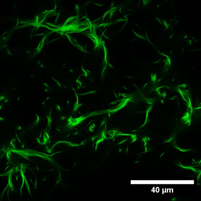 Microscope image showing the early stage of actin bundling in the presence of magnesium ions.