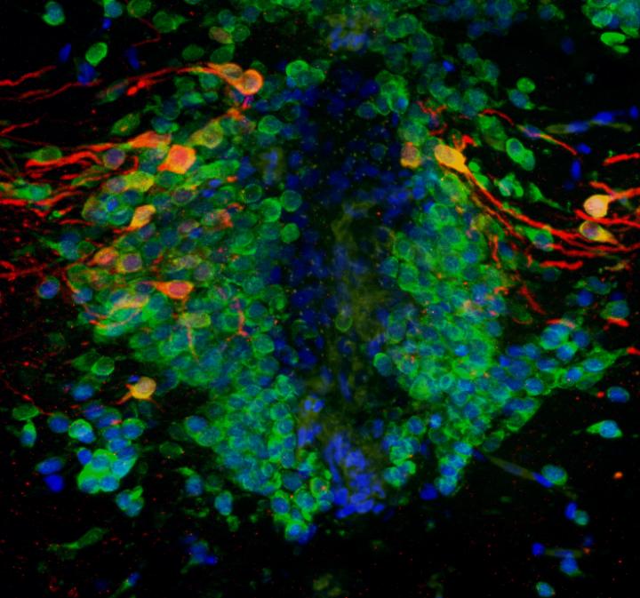 Dopamine-Producing Nerve Cells in the Zebrafish Brain