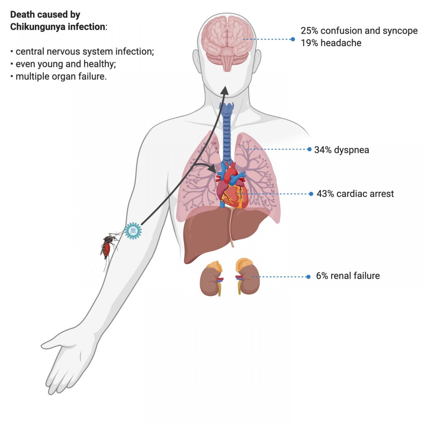 Chikungunya can infect the central nervous system