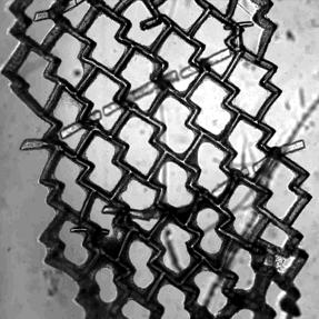 Tissue Velcro (1 of 2)