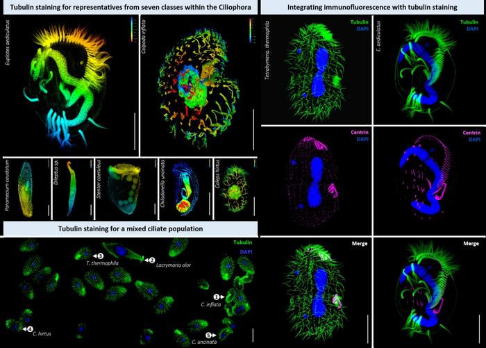 An improved method for tubulin staining of ciliated eukaryotes