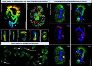 An improved method for tubulin staining of ciliated eukaryotes