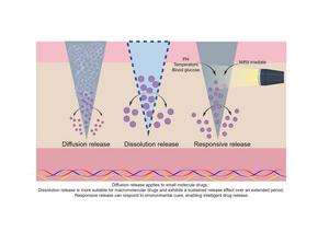 Release mechanisms of microneedle delivery