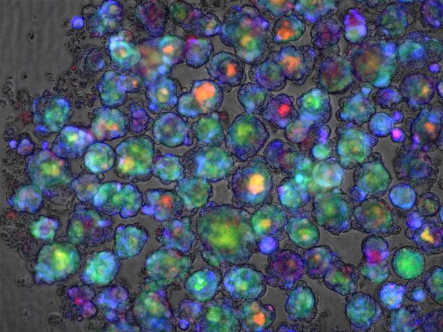 Color-stained confocal microscope image of multiple liver organoids used in this study