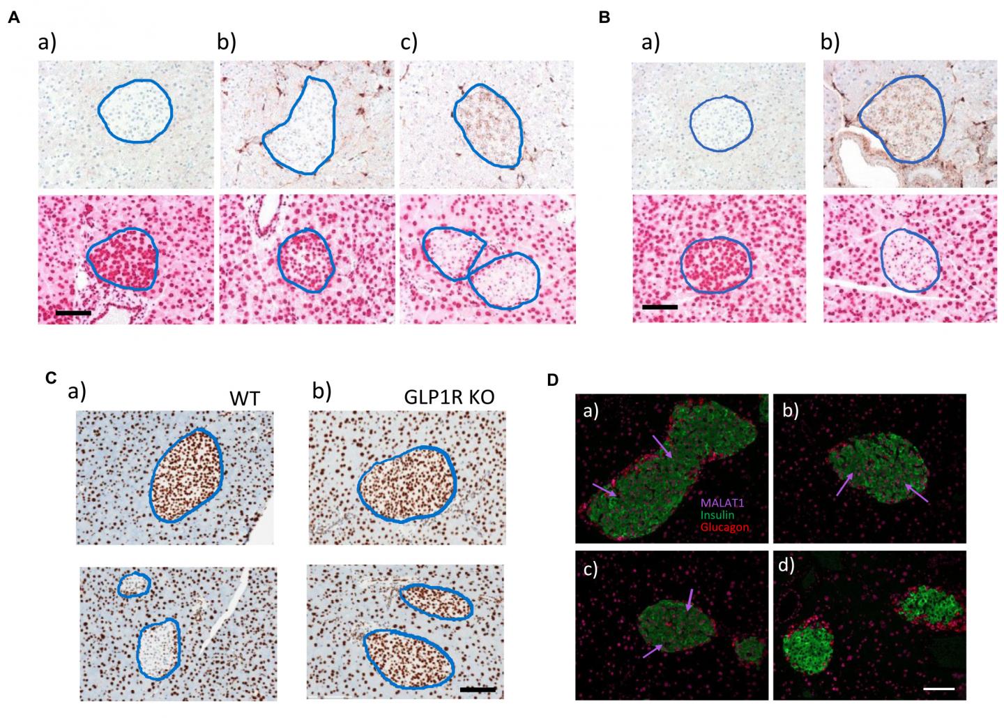 Increasing the Uptake of a Drug in Hard-to-Reach Pancreatic Cells (2 of 2)