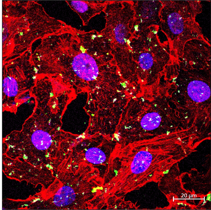 VLPs (visible as green dots) in cells (outlined by red colour)