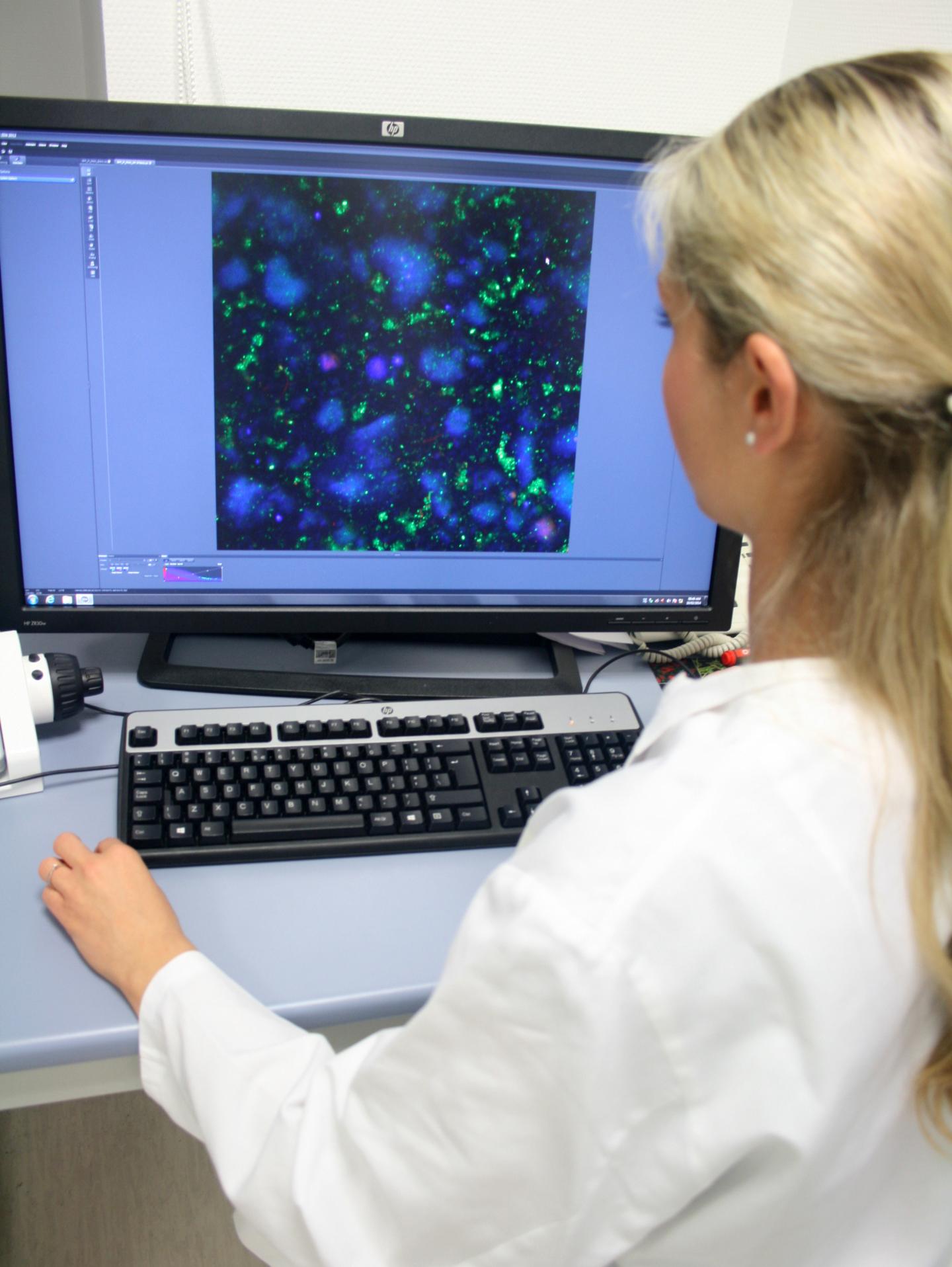Mareike Klinger-Strobel beim Mikroskopieren der Biofilme
