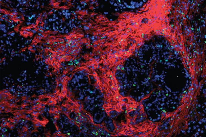 Immune-Based Therapy in Mice Shows Promise against Pancreatic Cancer