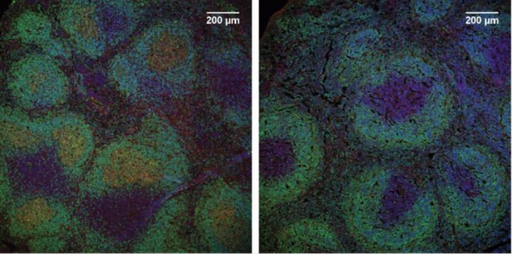Representative Images of Lymph Nodes