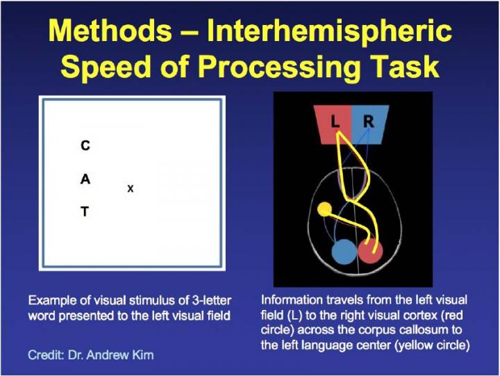 Concussion Alters How Information Is Transmitted Within the Brain