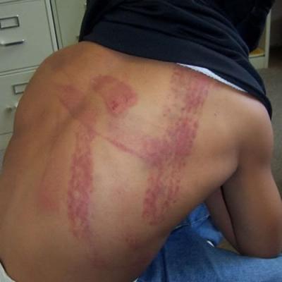 Corporal Punishment of Children