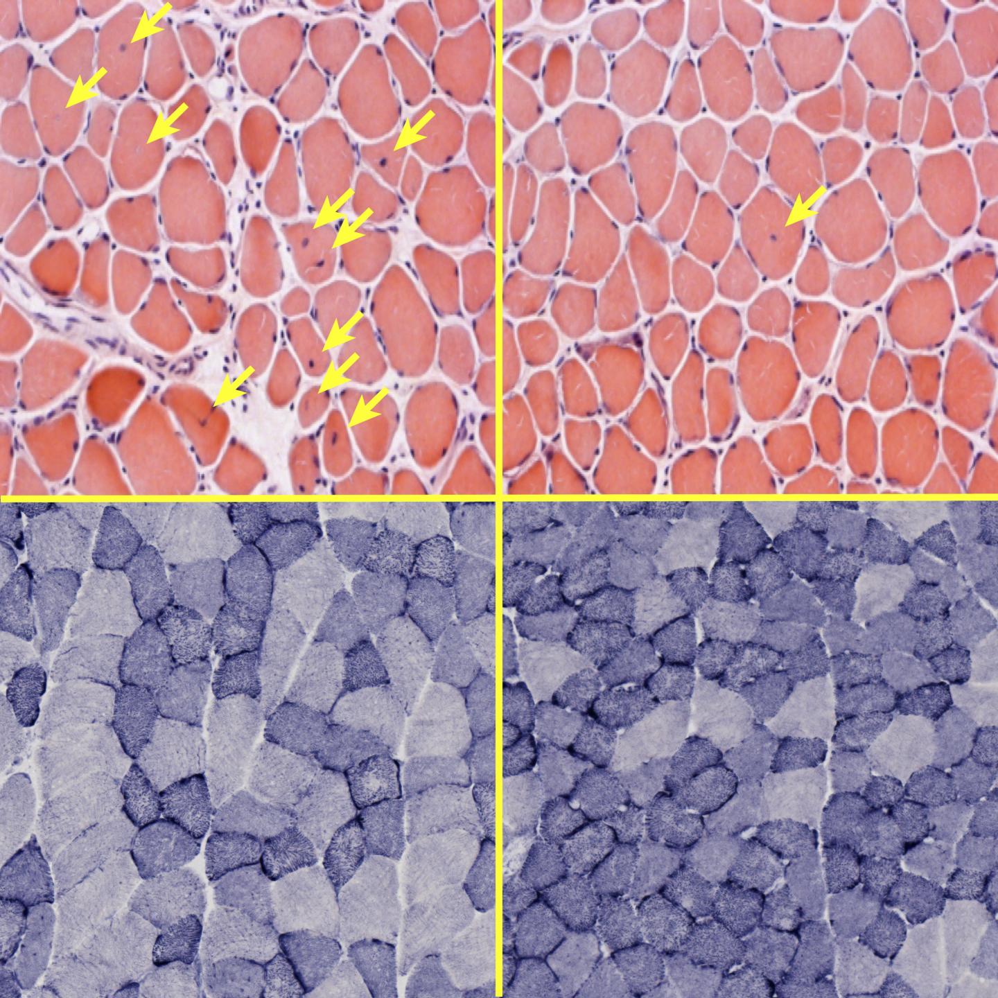 Salk Institute -- Evans lab -- ERRy Muscles