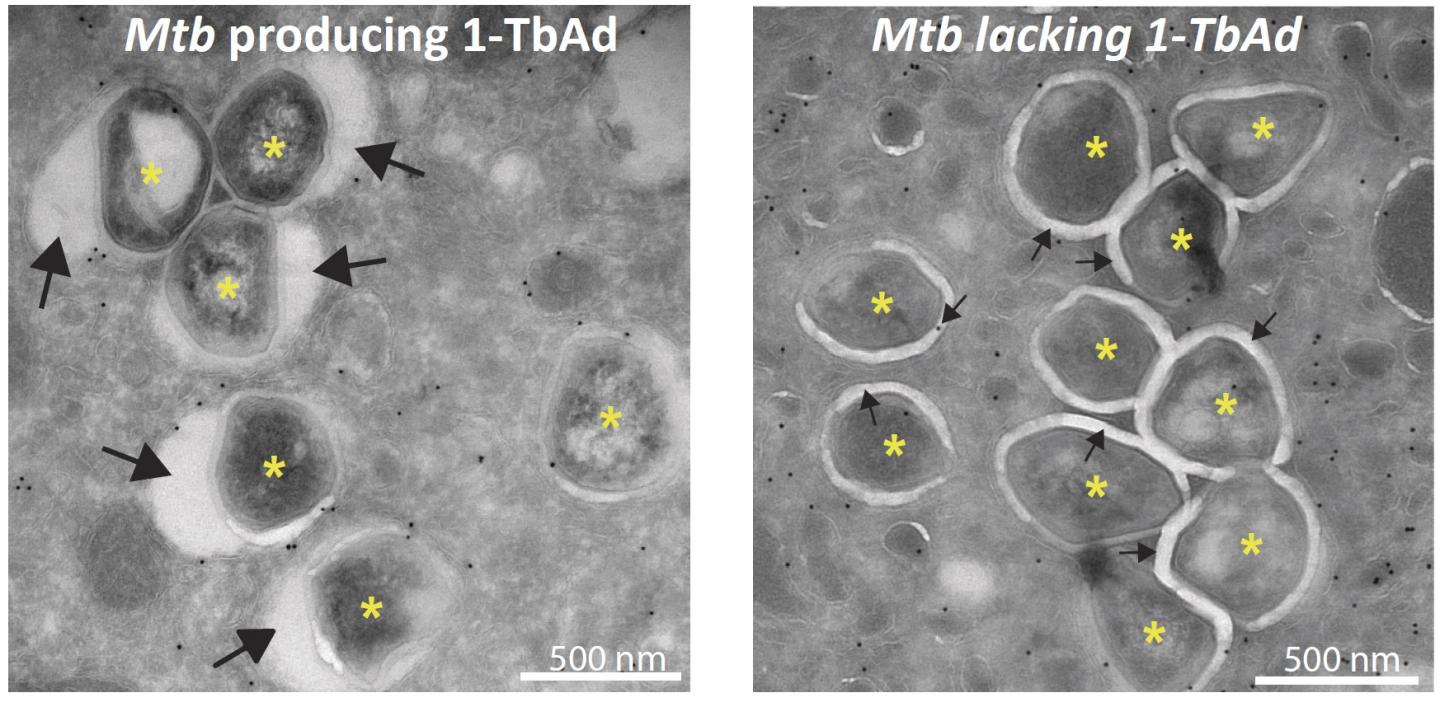 Macrophages Infected with Mycobacterium Tuberculosis