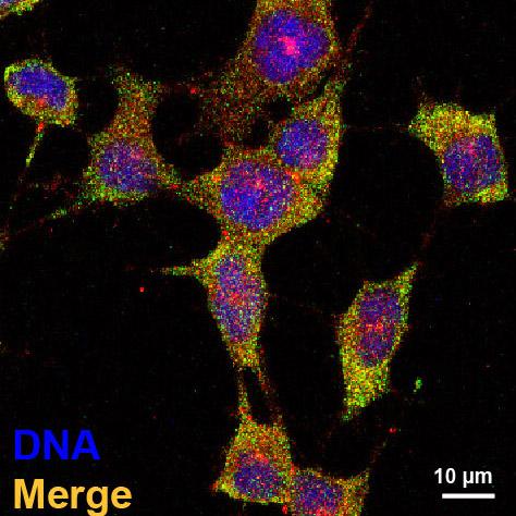 Gene Associated with Schizophrenia Risk Regulates Early Brain Development