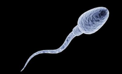 Sperm
