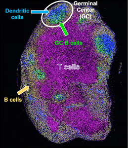 Alum and CpG adjuvant combination elicits robust immune response in aged mice