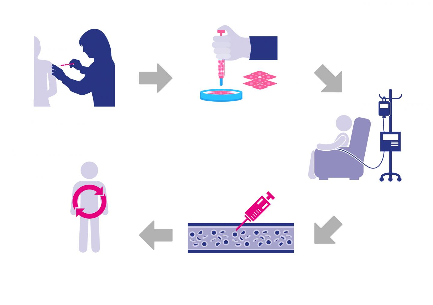 Diagram of Stem Cell Therapy (1 of 2)