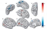 Brain Regions Associated with Donation