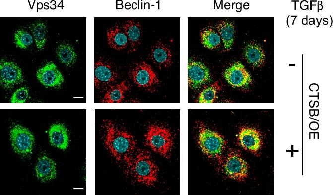 In the Absence of Disabled-2 , Vps34/Beclin-1 Interactions are Maintained