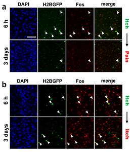 Figure 1. Visualization of Neurons Activated by Pain- and Itch-Inducing Stimuli