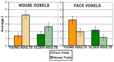 Functional Magnetic Resonance Imaging
