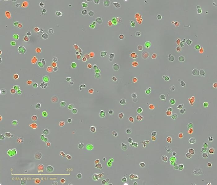 A new technique that makes competition between tumour cells visible can help personalise treatments for multiple myeloma