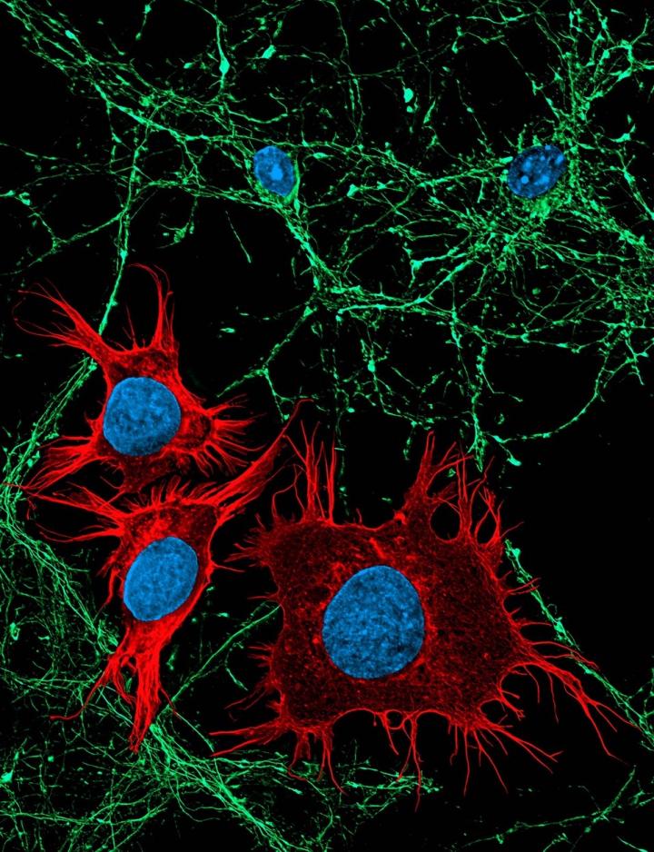 Neurons and medulloblastoma cells