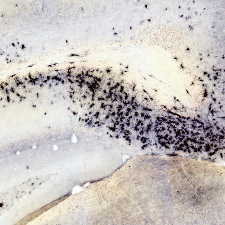 Microglia [IMAGE] | EurekAlert! Science News Releases