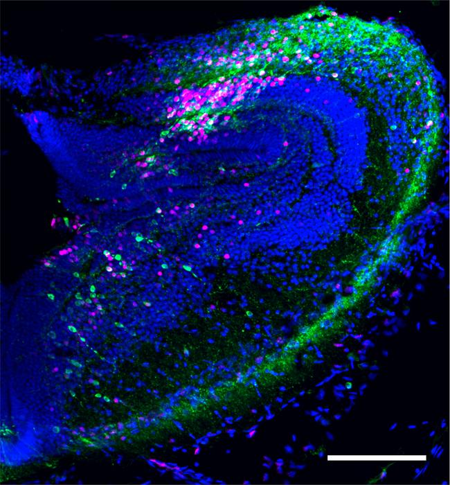 coronal section of the frog midbrain