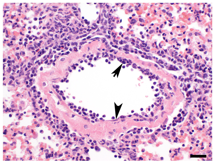 Endothelium [IMAGE] | EurekAlert! Science News Releases