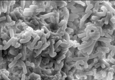 How Bad Bacteria Gain An Edge in the Gut