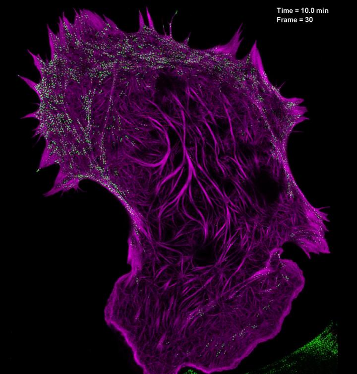 High Numerical Aperture Structured Illumination Microscopy (SIM) of Actomyosin Dynamics