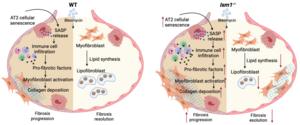 Proposed mechanism of action for ISM1 in regulating pulmonary fibrosis development and resolution using BIPF