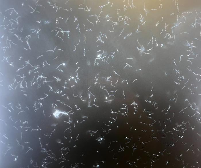 Highly virulent and infectious Lyme disease strain, Borrelia burgdorferi OspC type A genotype, has specific genetic elements which could provide clues to its spread