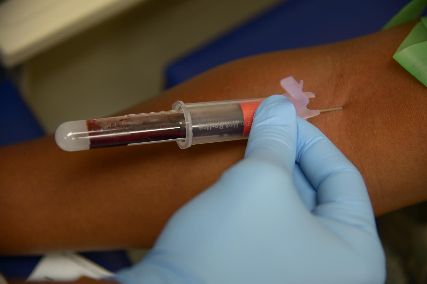 Blood Draw [IMAGE] EurekAlert! Science News Releases