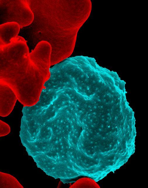 Blood Cell Infected with Malaria Parasites