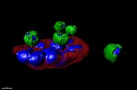 Tumor Cells on the Move