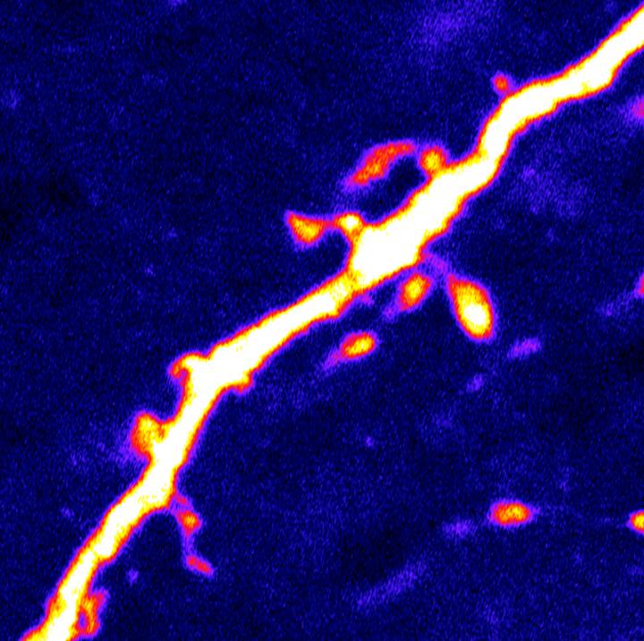 Dendritic Spines Jut out of An AgRP Neuron