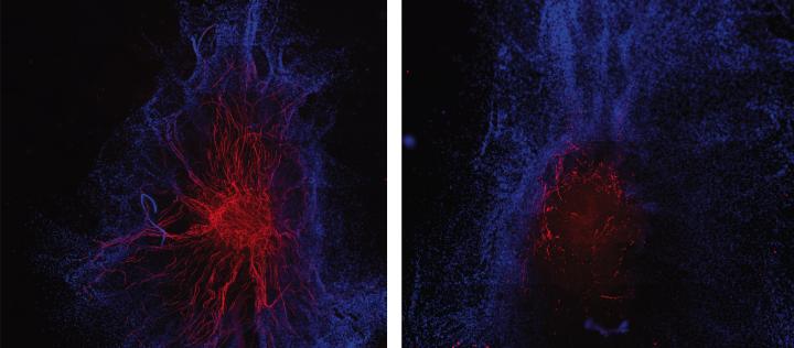 It Makes a Difference