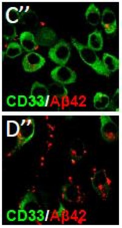 CD33 Over-Expressed or Inactivated and Beta-Amyloid